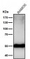 Anti-Mutant p53 Rabbit Monoclonal Antibody